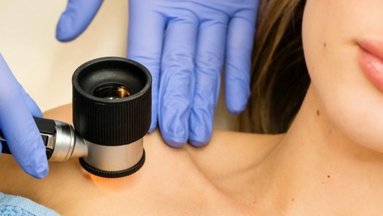 Dermatolog kao čuvar zdravlja kože