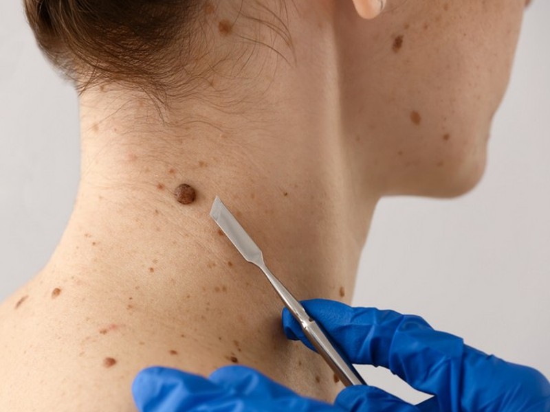 dermatolog provodi specijalizirane dijagnostičke postupke